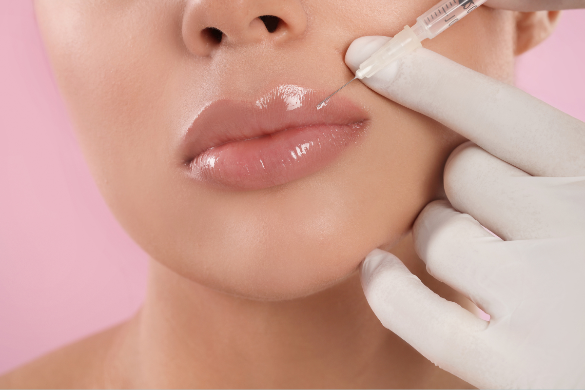 Lipfiller